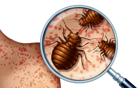 Dangers Caused by Bed Bugs