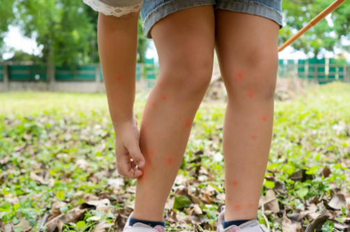 keep kids free from Pests infection